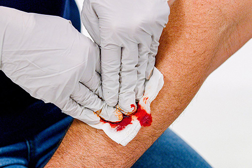 Stop The Bleeding Training